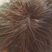 کلاه گیس|آرایشی، بهداشتی، درمانی|رشت, یخسازی|دیوار