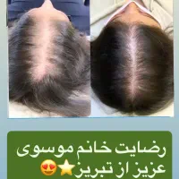 پک رشد سیبیل و ریش و جلوگیری از ریزش مو