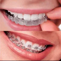 ارتودنسی تخصصی ثابت/ متحرک