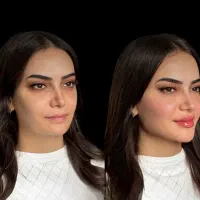 پایان جستجوکلینیک تخصصی پوست نخ ژل هایفو آموزش ژل|خدمات آرایشگری و زیبایی|تهران, زعفرانیه|دیوار