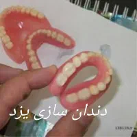 ساخت دندان کامپوزیتی بدون کام ثابت