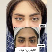 افرر عیدانه کلنیک رنسانس