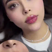 تزریق ژل و فیلر کل صورت
