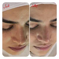 پاکسازی و فیشیال