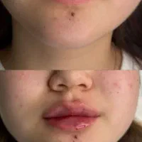 کلینیک زیبایی لومیس