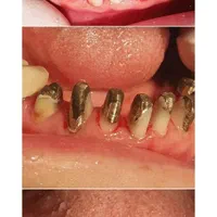 مناسب ترین قیمت دندانپزشکی در استان باسه سال ضمانت|خدمات آرایشگری و زیبایی|یاسوج, |دیوار