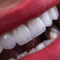 دندانپزشکی،ایمپلنت دیجیتال،اوردنچر،کامپوزیت،لمینت|خدمات آرایشگری و زیبایی|خوی, |دیوار
