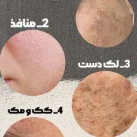 سرم مغذی و ویتامین آ، کرم ضد لک لاکچری کوین|آرایشی، بهداشتی، درمانی|نیشابور, شهرک بسیج|دیوار
