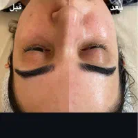 فیشال پوست برای خانمهاوآقایان|خدمات آرایشگری و زیبایی|کرمانشاه, |دیوار