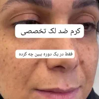 کرم ضد لک تخصصی