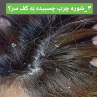 پاکسازی کف سر،درمان ریزش،شوره چربی سروضخیم سازی مو|خدمات آرایشگری و زیبایی|نیشابور, هفده شهریور|دیوار