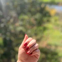 کاشت ترمیم و لمینیت ناخن