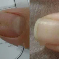 مشاوره درمانی|خدمات آرایشگری و زیبایی|شیراز, حافظیه|دیوار