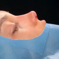 جشنواره تابستانه عمل زیبایی بینی فقط ۳۸ تومن