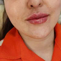 آموزش وخدمات ژلوبوتاکس.پرسینگ.حجامت.زالو.پرستاری|خدمات آرایشگری و زیبایی|پرند, فاز ۲|دیوار