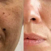 آموزش آلگاپیل (تکنیک پوست مار)|خدمات آموزشی|لنجان, |دیوار