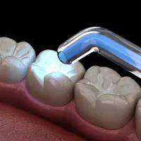 سلامت دندان طراحی خط لبخند آزاداقساطی بیمه تکمیلی|خدمات آرایشگری و زیبایی|ماهان, |دیوار