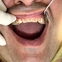 خدمات دندان پزشکی با متناسب شرایط و بودجه شما|خدمات آرایشگری و زیبایی|رودبار, |دیوار