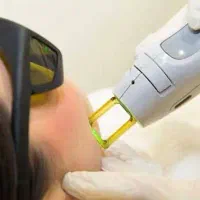 آگهی استخدام اپراتور لیزر موهای زائد (خانم)