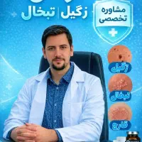 زگیل و تبخال