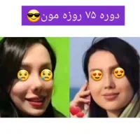 پک چاقی صورت بدون عوارض