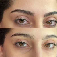 میکروبلیدینگ ابرو