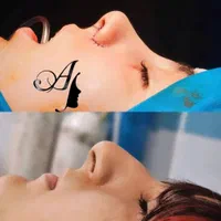 جراحی زیبایی بینی فقط با 22 ملیون|خدمات آرایشگری و زیبایی|شاهرود, |دیوار