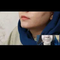 تخفیف بوتاکس و ژل|خدمات آرایشگری و زیبایی|دورود, |دیوار