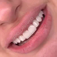 کامپو‌‌زیت طرح لمینت فکی 15 الی 30