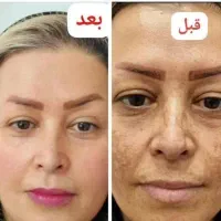 عمده. کرم سفید کننده