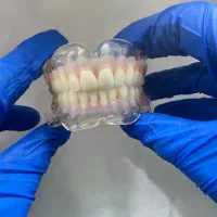 دندانسازی ( دندان مصنوعی) اقساطی