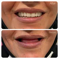 دندان مصنوعی تخصص ماست..