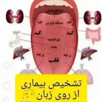 جشنواره روز پدر حجامت زالو طب سوزنی فصد امبدینگ