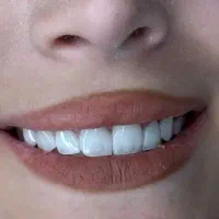 .تخفیف ویژه دندان پزشکی .کامپوزیت.وتمام خدامات|خدمات آرایشگری و زیبایی|اردبیل, |دیوار