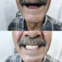 لابراتوار دندانسازی تخصصی(ساخت دندان مصنوعی)|حراج|اصفهان, کشاورزی|دیوار