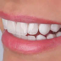 دندانپزشکی با ۵۰ درصد تخفیف