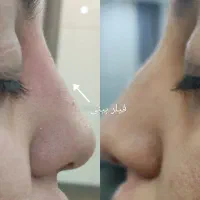 ترریق ژل و بوتاکس|خدمات آرایشگری و زیبایی|اصفهان, کوی شهید کشوری|دیوار