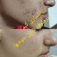 یه قدم تا سلامتی با طب سنتی