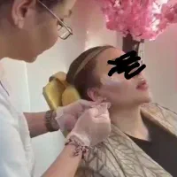 تزریق بوتاکس مزو صورت وسر
