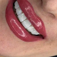 تخفیفات پاییزه کامپوزیت ونیر مدت محدود