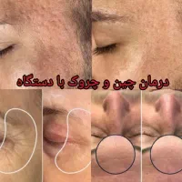 انجام خدمات پوستی هم اقایان هم بانوان