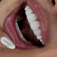 دندانپزشکی شمرون/ کامپوزیت/ارتودنسی