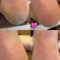 شروع تخفیفات باور نکردنی جشنواره فروردین ماه