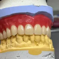 ساخت دندان مصنوعی وروکش،سه ساعت تحویل، شبانه روزی