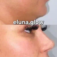 مطب زیبایی وجوانسازی پوست و مو الونا درتخفیف ویژه