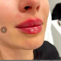 ادمین حضوری پذیرش