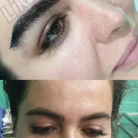 تخفیف ویژه کاشت ابرو سه بعدی با ضمانت نامه