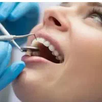 جشنواره تخفیف ویژه دندانپزشکی،موادعالی،بیمه تکمیلی