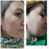 کرمپودر دائم ریمو تتو پوست کره ای