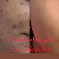 کرم ضد لک و جوش خاویار|آرایشی، بهداشتی، درمانی|رشت, کوی جام جم|دیوار